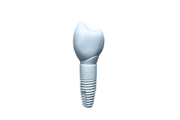 Dental Implant